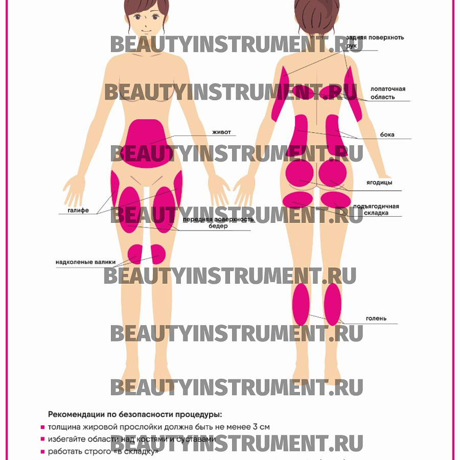 Плакат А3 для косметолога "Зоны обработки для Ультразвуковой кавитации"