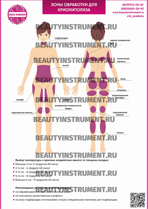 Купить Плакат А3 для косметолога "Зоны обработки для криолиполиза" по цене 1 490 руб.