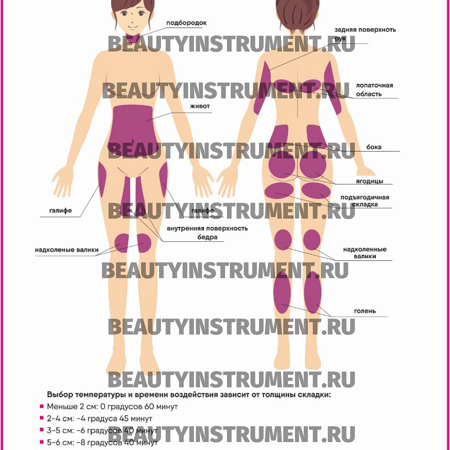 Плакат А3 для косметолога "Зоны обработки для криолиполиза"