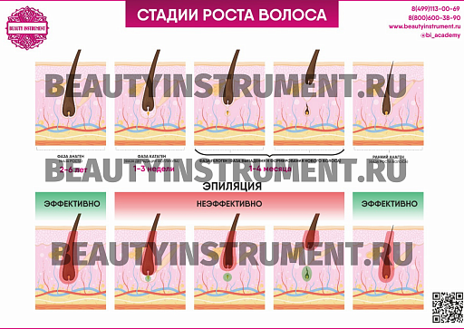 Купить Плакат А3 для косметолога "Стадии роста волос и эффективность эпиляции" по цене 1 490 руб.